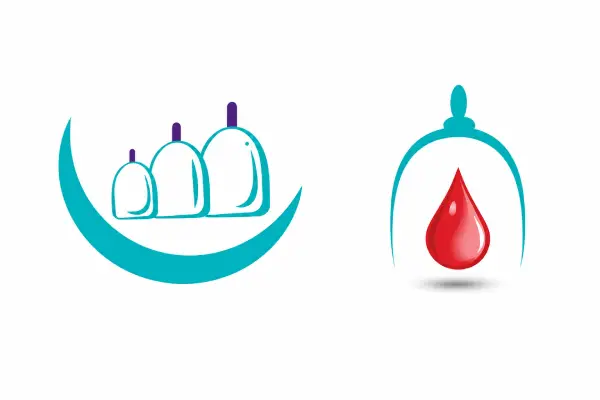 أفضل مراكز الحجامة والطب الشعبي في السعودية